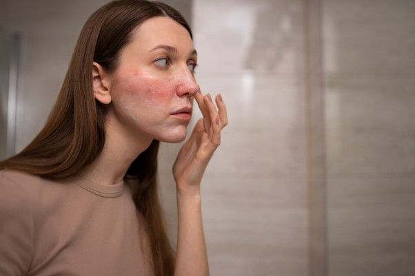 skin barrier may